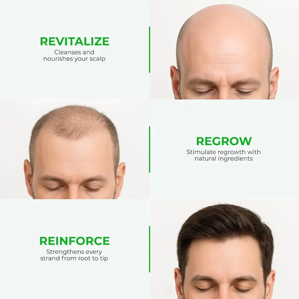 Neo Hair Lotion 育髮精華素 120ml (正貨保證，泰國直送）<$168起>